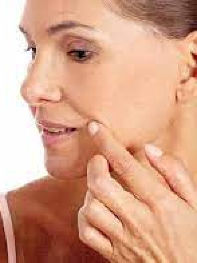 ৩০-এই বুড়িয়ে যাচ্ছেন-বলিরেখা? রইল সমাধান