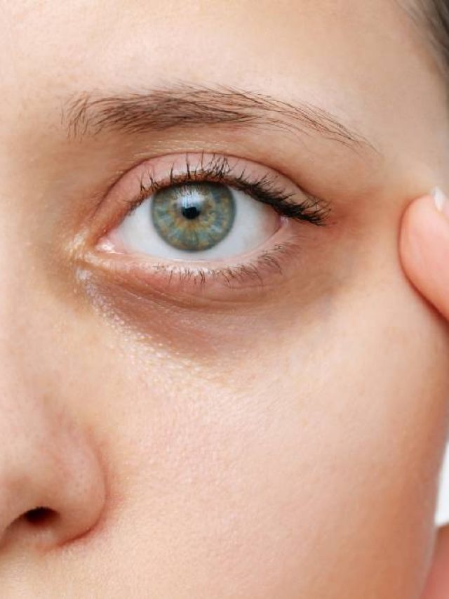 চোখের এই ৩ ইঙ্গিত বলে দেয় হার্ট অ্যাটাকের ঝুঁকি, বাঁচার উপায়?