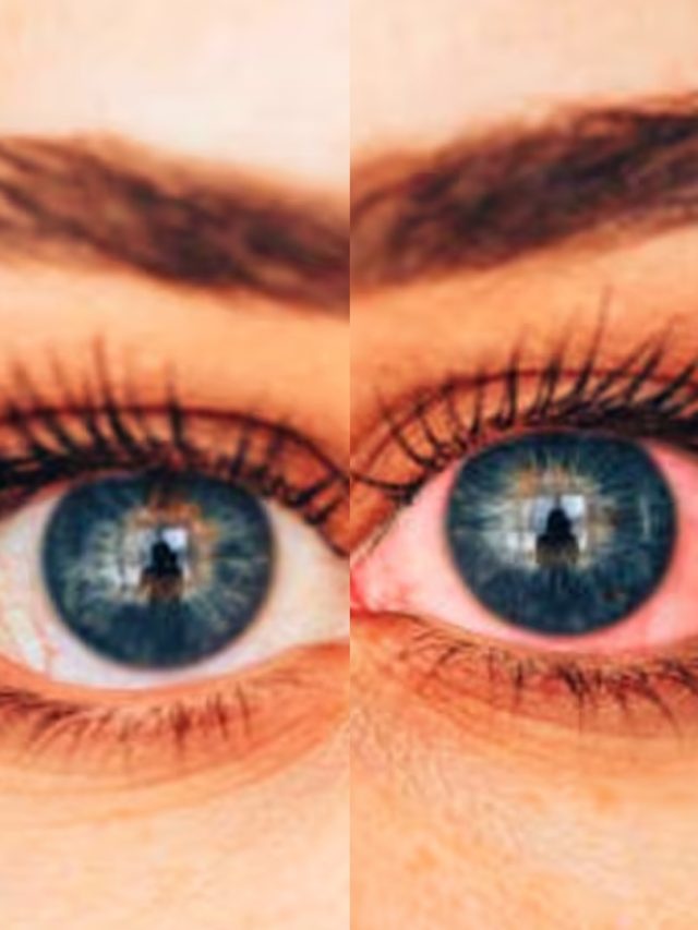 ২৪ ঘণ্টায় সারবে জয় বাংলা, গরম জলে যা দেবেন