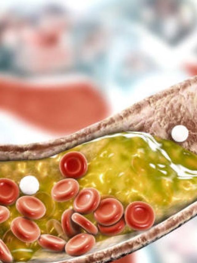 ৫ পানীয় কন্ট্রোলে রাখতে পারে কোলেস্টেরল