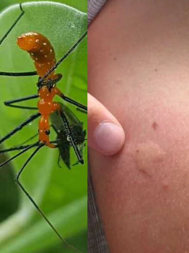 মশা-পোকার কামড়ে জ্বালা-ফোলাভাব? ৫ ঘরোয়া টিপস