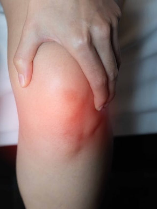 বাতের ব্যথা থেকে মুক্তি চাইছেন? রইল কিছু ঘরোয়া টোটকা