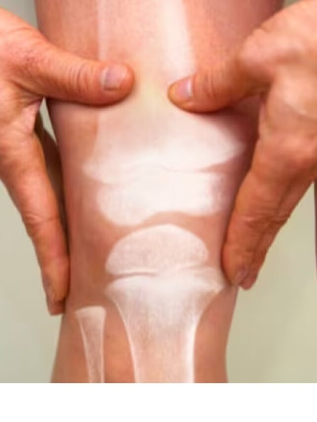 ইউরিক অ্যাসিডে অসহ্য ব্যথা? ৩ টিপসে আরাম