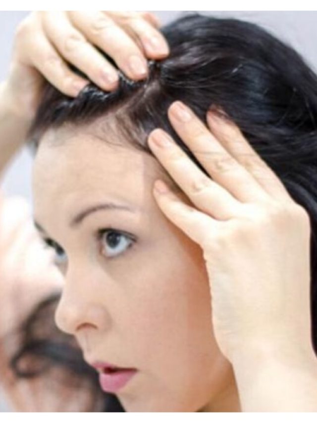 শীতে শুষ্ক স্ক্যাল্পে খুশকিতে নাজেহাল? এভাবে সমস্যা মিটবে