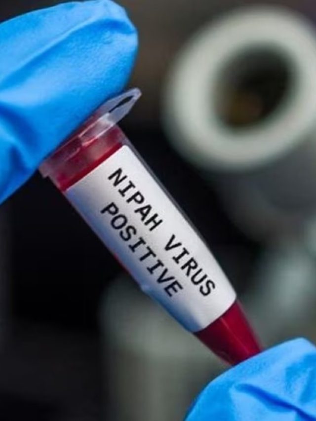 নিপা ভাইরাসে মৃত্যুর হার ৭০%, সতর্ক করল ICMR
