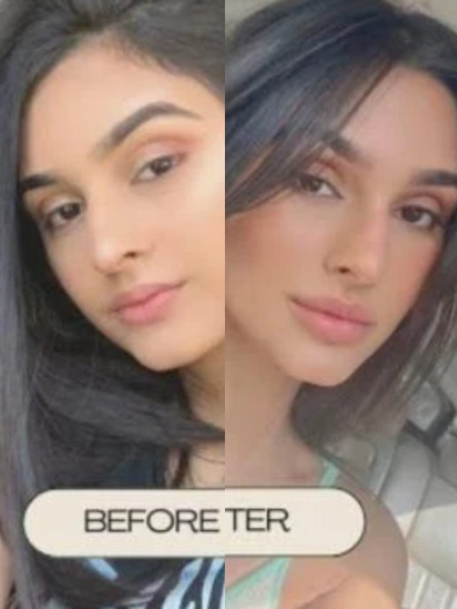 सुर्खियों में जावेद जाफरी की बेटी, लिप फिलर पर की खुलकर बात, दिखाया ट्रांसफॉर्मेशन