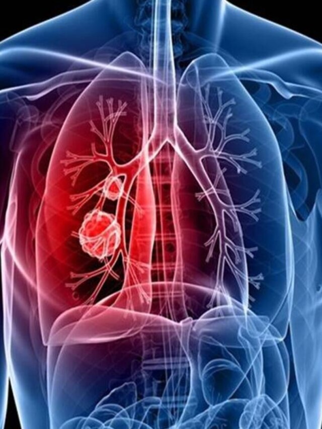 একটু হাঁটলেই শ্বাসকষ্ট? এই ৫ পানীয় রাখে ফুসফুস চাঙ্গা