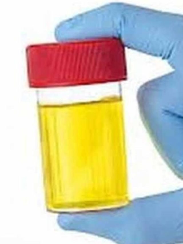 কোন সময় জল খেলে প্রস্রাবের রং হলুদ হবে না?