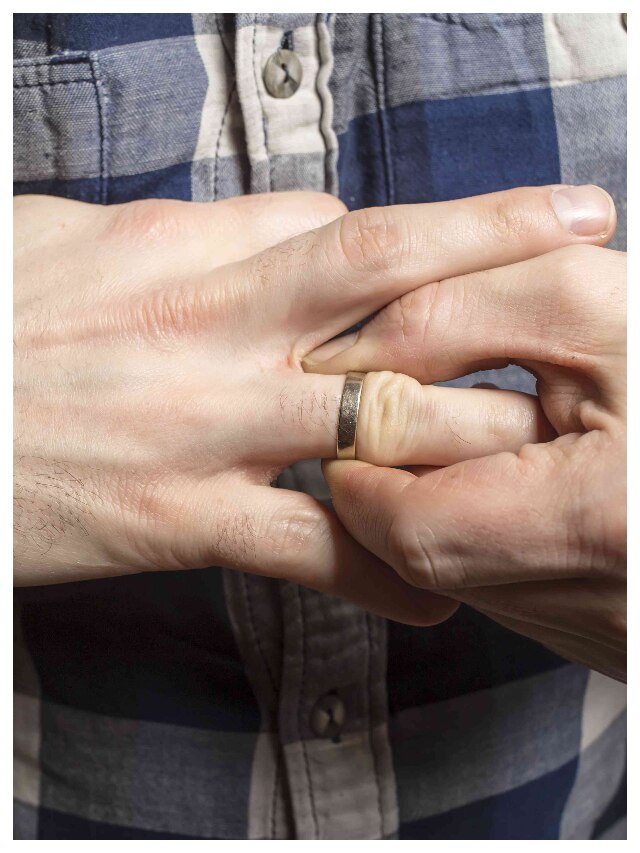 আংটি আঙুলে আটকে গিয়েছে? সহজ উপায়ে খুলুন