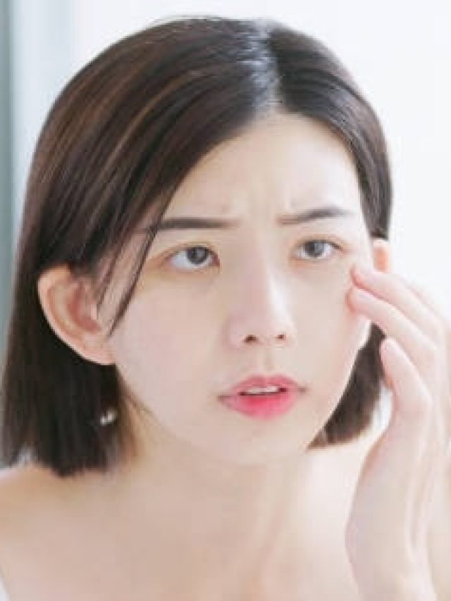 आंखों के नीचे बढ़ गए हैं काले घेरे? इन चीजों को खाने से दूर होगी समस्या