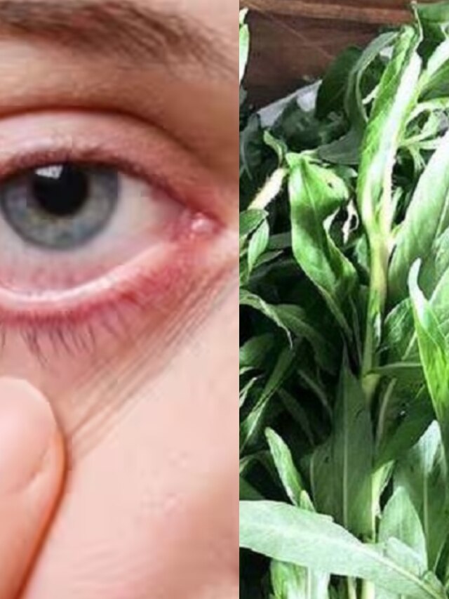 এই লক্ষণগুলি অ্যানিমিয়ার, ৮ খাবারেই শিরায় শিরায় ভরবে রক্ত