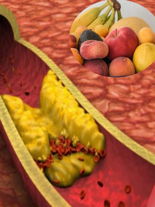 এক ফলেই কমতে পারে কোলেস্টেরল, কীভাবে খাবেন?