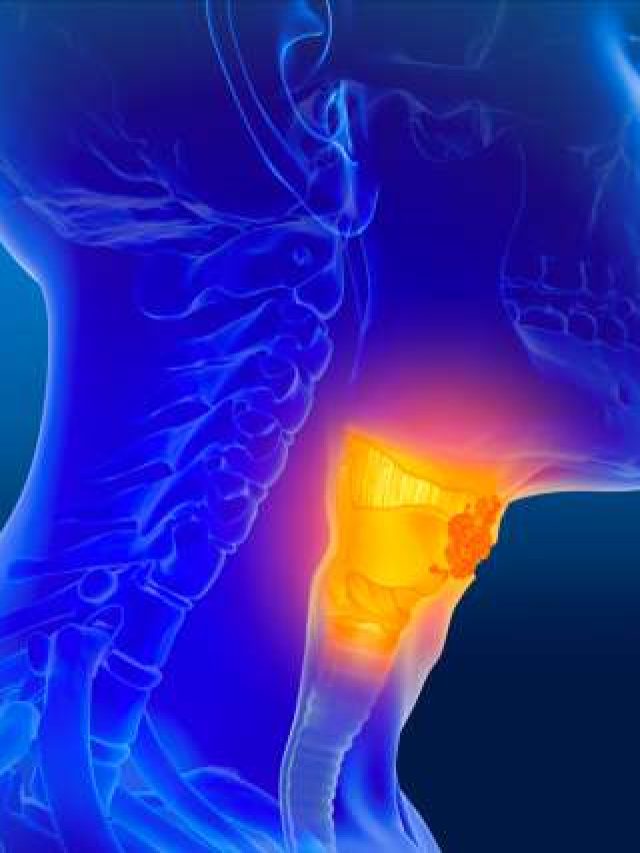 এই দুটি জিনিস এড়ালেই হবে না মাথা-ঘাড়ের ক্যান্সার