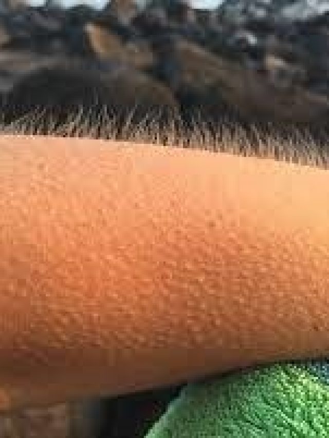 ভয়ে মানুষের লোম খাডা হয়ে যায় কেন, রহস্যটা কী?