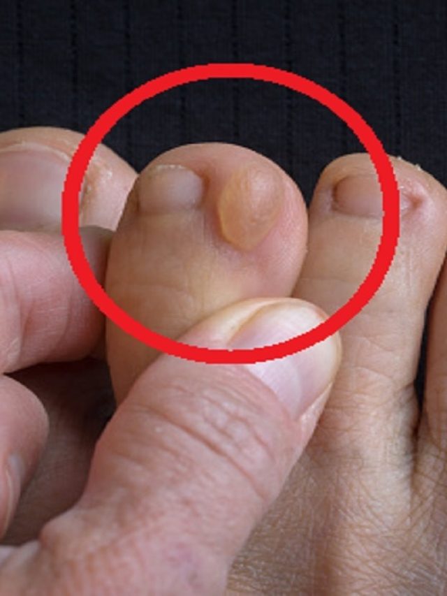 পুজোয় নতুন জুতো পরে পায়ে ফোস্কা? সমাধান জেনে নিন