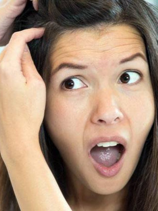 বাজারের ওষুধ-তেলে ক্ষতি চুলের, উকুন তাড়ান  ৫ ঘরোয়া টোটকায়