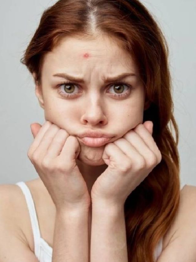 পুজোর চারদিন মেকআপ করে মুখে ব্রণ? ঘষে নিন এক টুকরো বরফ