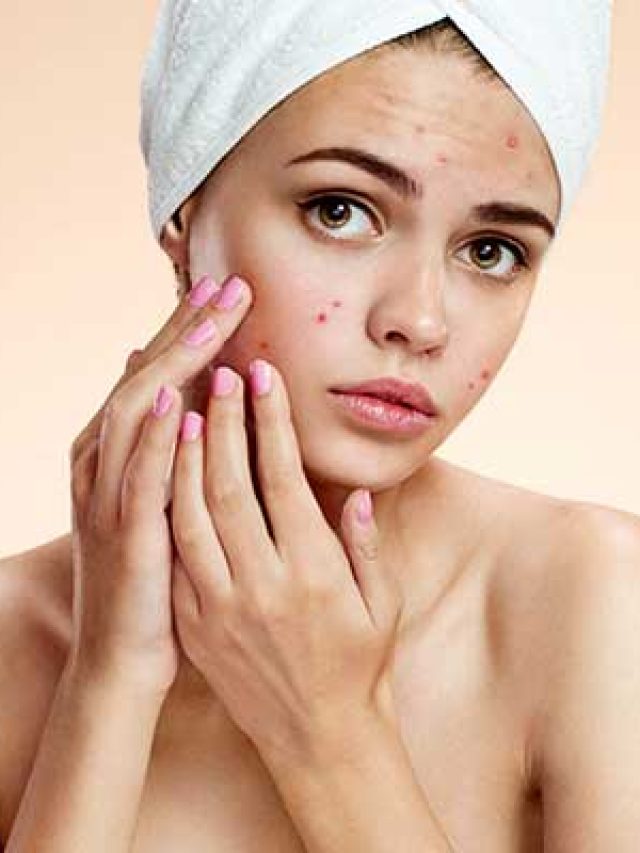 থুতু দিলে কি ব্রণ সেরে যায়? সুস্থ ত্বক পেতে সত্যিটা জানুন