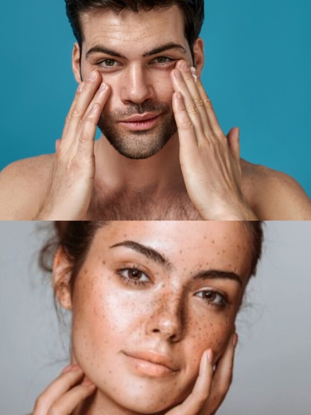 ভিটামিন ই-র অভাবে মুখ হচ্ছে কালো? জেল্লা ফেরান এই ৫ খাবারে