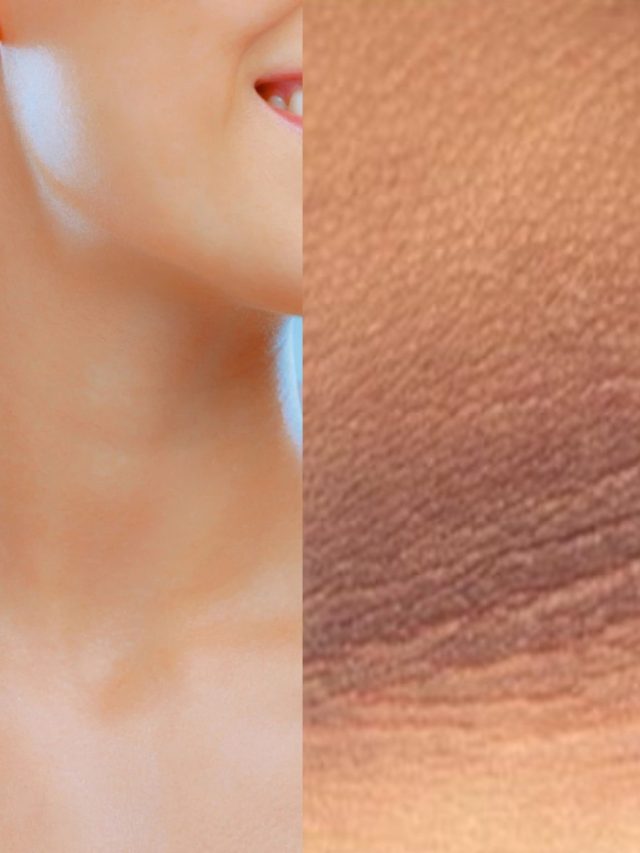 ঘাড় ও গলার কালো ছোপ? এই টোটকায় দূর হবে নিমেষে