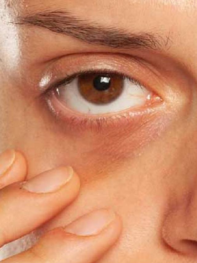 চোখেও যে স্ট্রোক হয় জানতেন? জেনে রাখুন লক্ষণ, সাবধানতা