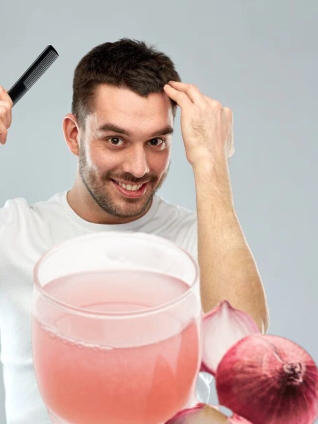 চুল পড়া বন্ধ করে পেঁয়াজের রস, খালি মাথায় দেওয়ার ট্রিকসটা জানুন