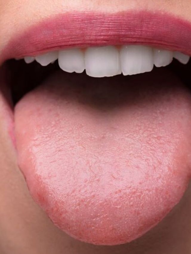 জিভের কেমন রং বলে দেয় ক্যান্সার হতে পারে? কেমন জিভ সুস্থতার লক্ষণ?