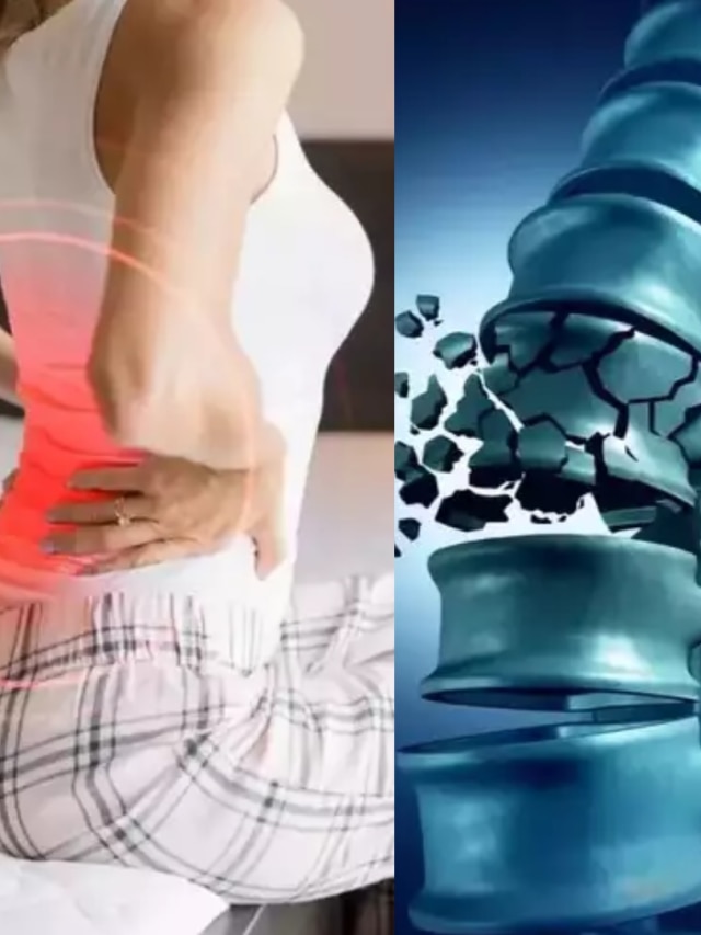 সাবধান! এই ৫ ধরনের খাবার দুর্বল করে হাড়, কম বয়সেই হবেন অথর্ব