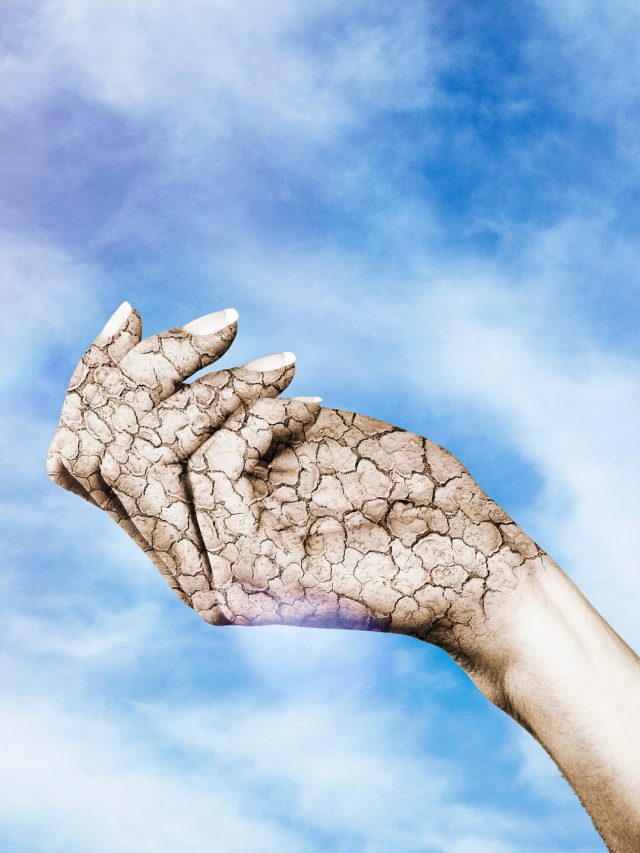 ৫ কারণ ও উপায়: শীতে শুষ্ক ত্বক-চুলকানি থাকবে দশ হাত দূরে