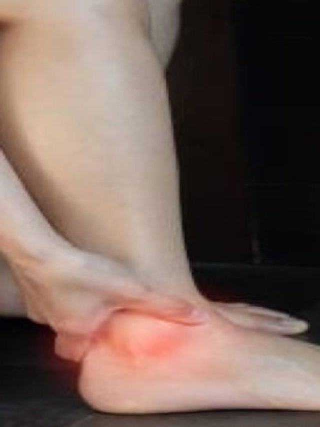 শীতে বাড়ছে ইউরিক অ্যাসিডের ব্যথা? ৮ খাবার ছাড়ুন, আরাম পাবেনই