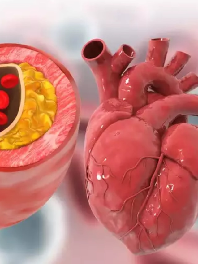 শীতে হার্টব্লকেজ বাড়ে, ৭ লক্ষণে আগাম জানুন, এভাবে এড়ান বিপদ