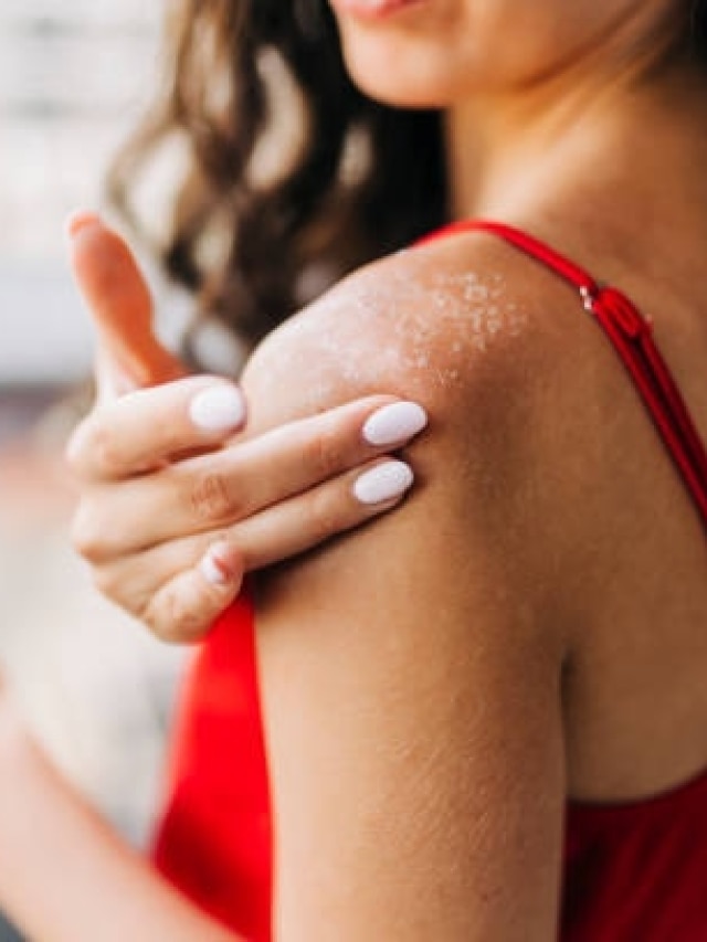 सूखी त्वचा में फायदेमंद है ये देसी नुस्खे, गर्मियों में जरूर आजमाएं