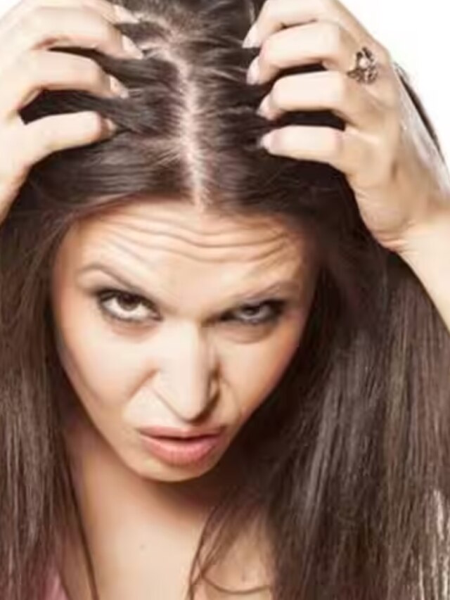 উকুন নিয়ে নাজেহাল? এই ঘরোয়া উপায়ে ৭ দিনেই সমাধান