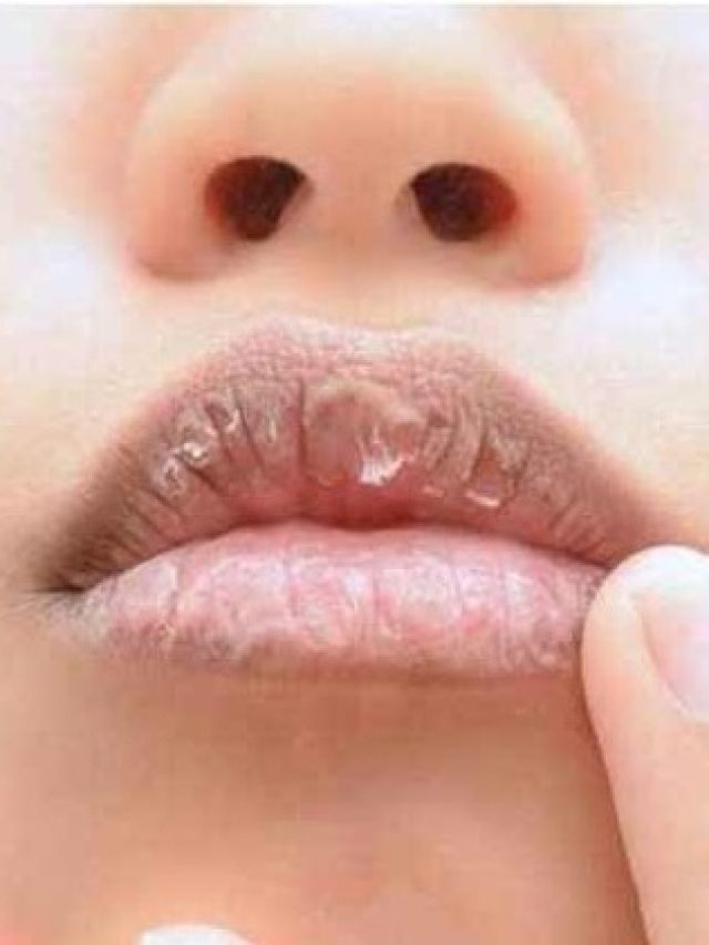 শীতে ফাটছে ঠোঁট, গোড়ালি? এই শাক খেলেই সারবে নিমেষে