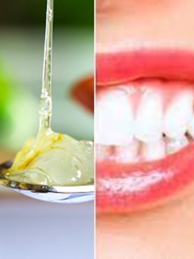 দাঁতে ক্যাভিটি-দুর্গন্ধ? এই ভেষজ ঘষলেই হবে ঝকঝকে