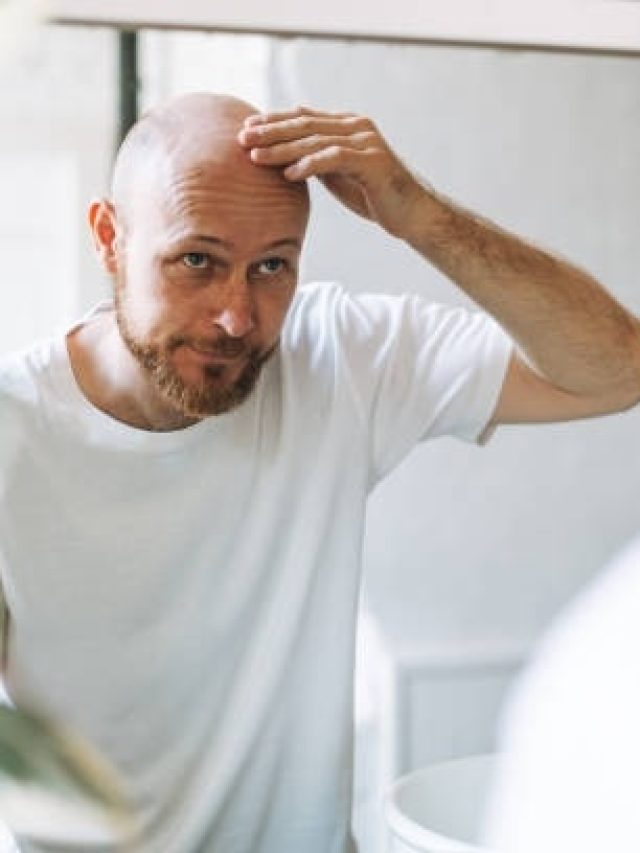भारतीय पुरुषों में तेजी से बढ़ रही है गंजेपन की समस्या, इन उपायों से पाएं निजात