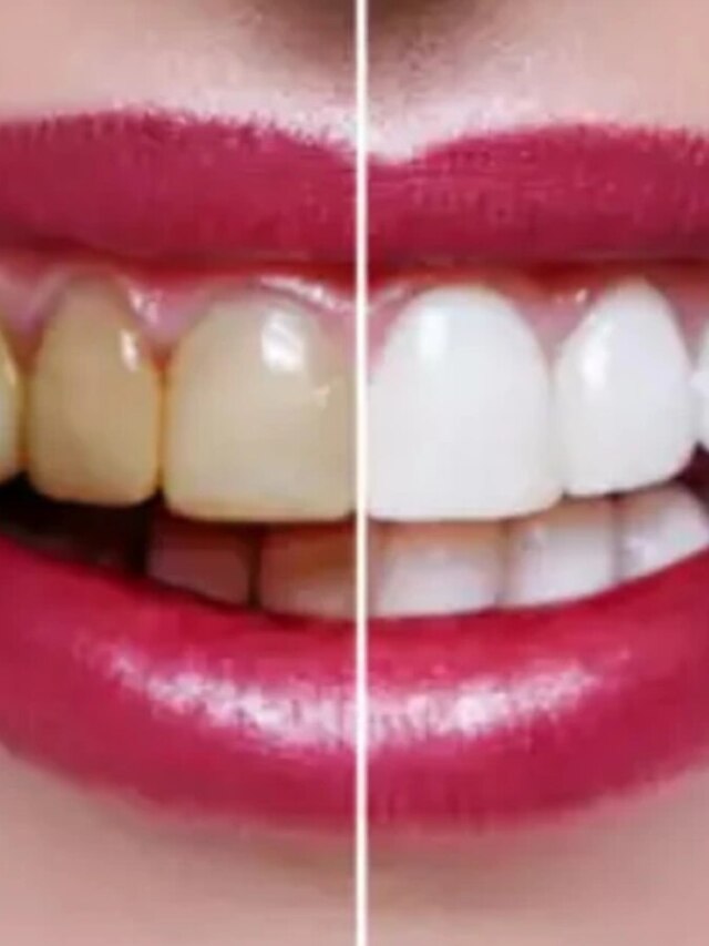 দাঁত হবে মুক্তোর মত ঝকঝকে, রোজ ব্রাশ করুন এই ফলের খোসা দিয়ে