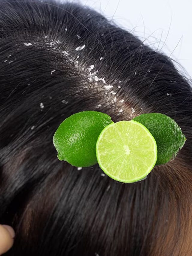 লেবু-নারকেল তেলের এই টোটকাতেই গায়েব হবে খুসকি