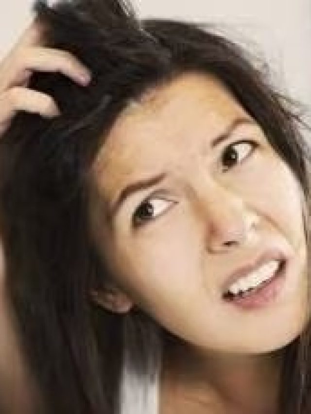 শীতে বাড়ে খুশকির সমস্যা, কীভাবে ভাল রাখবেন চুল?