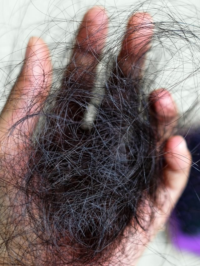 মুঠো মুঠো চুল উঠে PCOD-র জন্য টাক পড়ছে? এভাবে সমাধান পাবেন