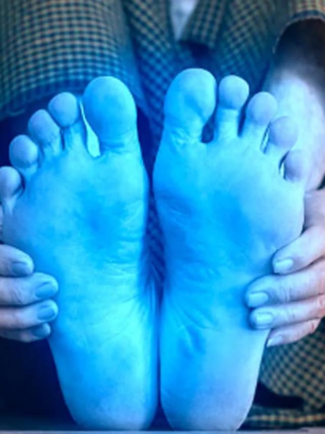 হাত-পা ঠান্ডা থাকছে? এই ভিটামিনের অভাব, যা যা খাবেন