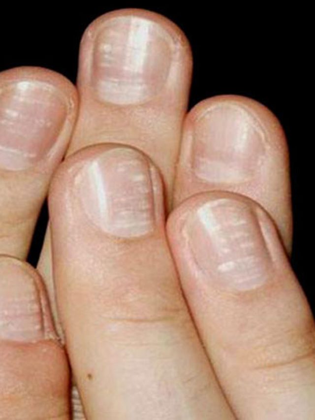 নখের আকার ছোট-বেঁটে হলে তার স্বভাব কেমন হয়?