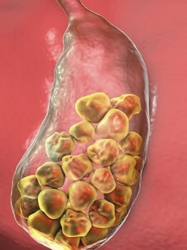 রোজকার এই ৫ খাবার খেলেই গলব্লাডারে জমে পাথর, এখনই সাবধান হোন