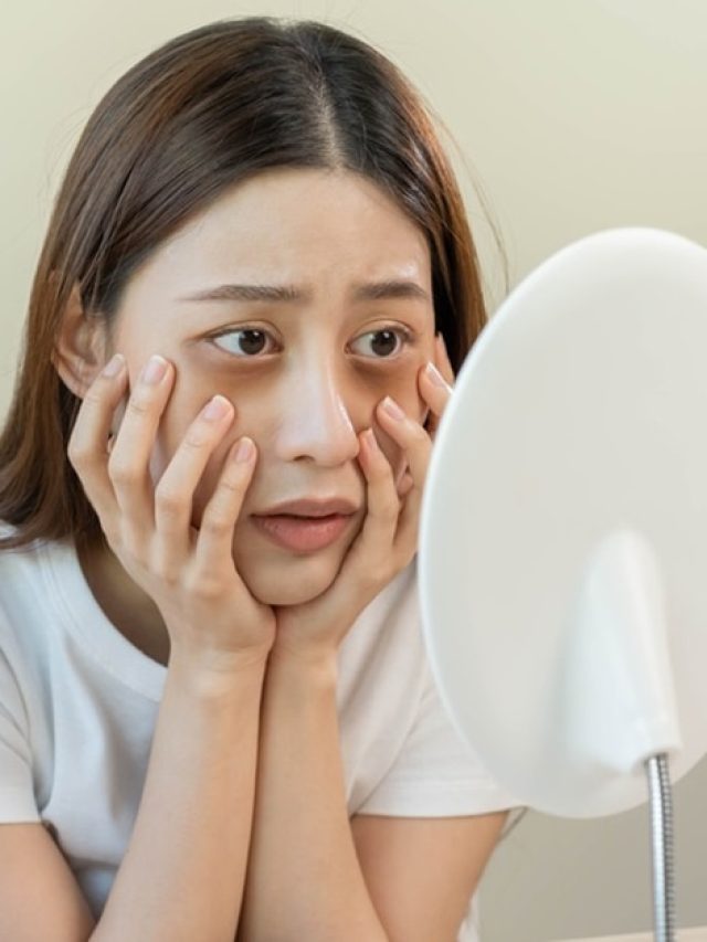 ২০ দিনেই দূর হবে মুখের ডার্ক সার্কেল, থাকল অর্ব্যথ টোটকা