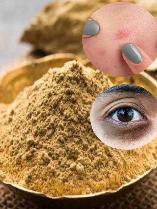 হবে না ব্রণ, উঠবে চোখের তলার দাগও, এই ভেষজেই হবে কাজ