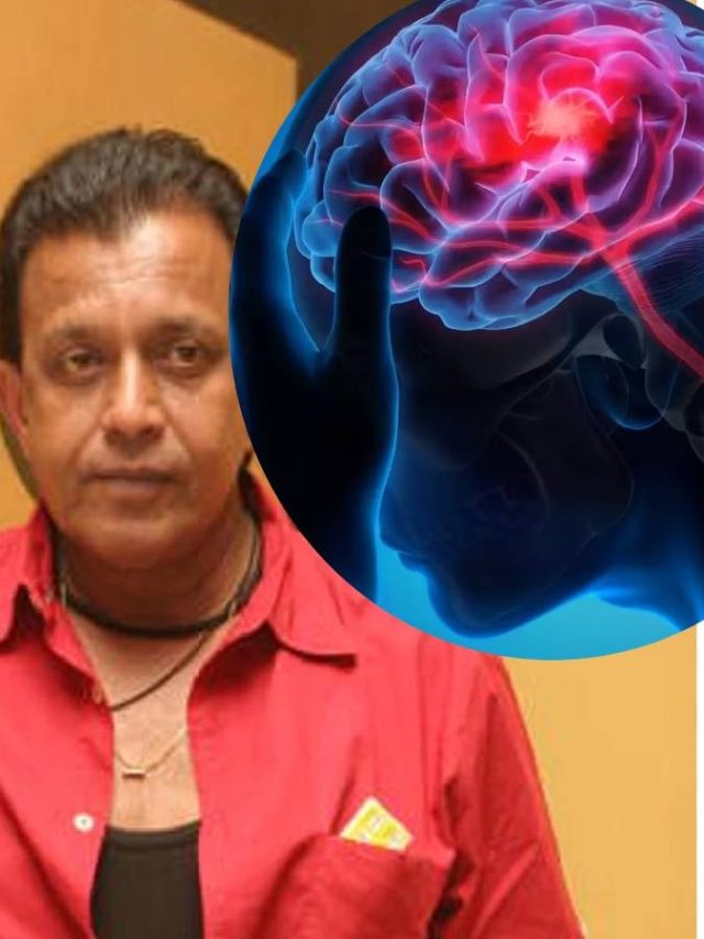 মিঠুনের ব্রেন স্ট্রোক, এই রোগের ঝুঁকি কাদের-লক্ষ্মণ কী কী ?