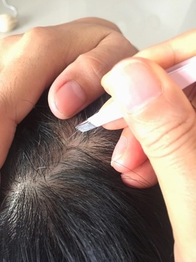 পাকা চুল টেনে তুললেই বিপদ! সত্যি নাকি মিথ? জানুন