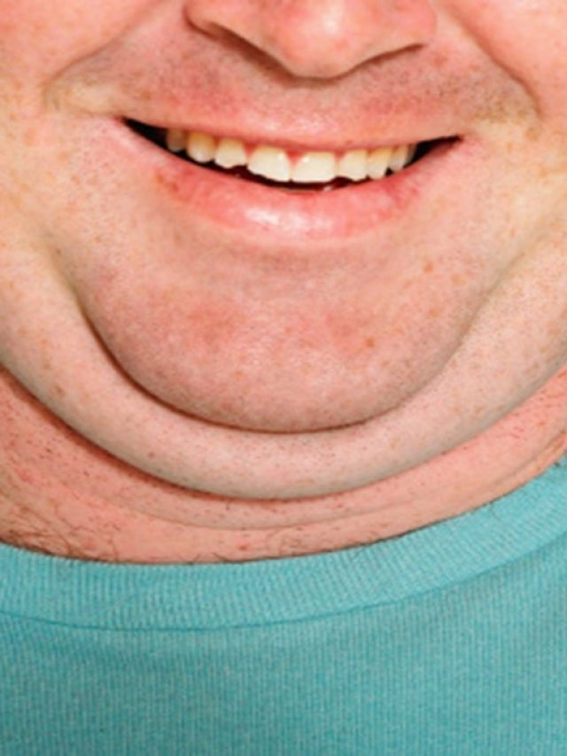 ডাবল চিন হয়ে বয়স একেবারে দ্বিগুণ লাগছে? কমানোর সহজ উপায়