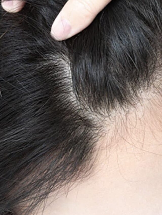 এই ৪ ঘরোয়া টোটকায় বয়স ৩০ পেরোলেও চুল হবে লম্বা ও ঘন