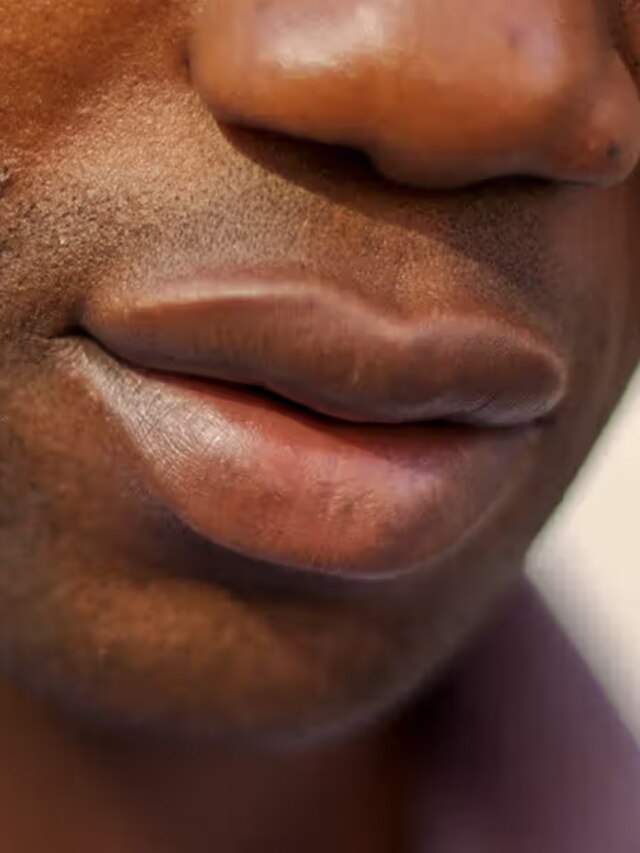 এই ৫ কারণেই কম বয়সে কালো হচ্ছে ঠোঁট, জানুন প্রতিকার